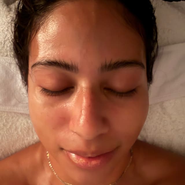 Linder health peel series at Michaela's Glow in Port Orange, FL