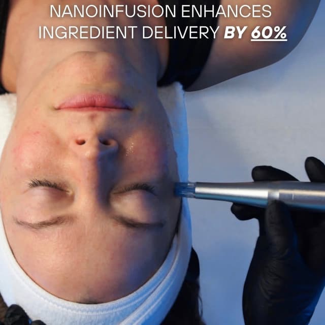 Million Dollar Nano Facial Serie at Michaela's Glow in Port Orange, FL